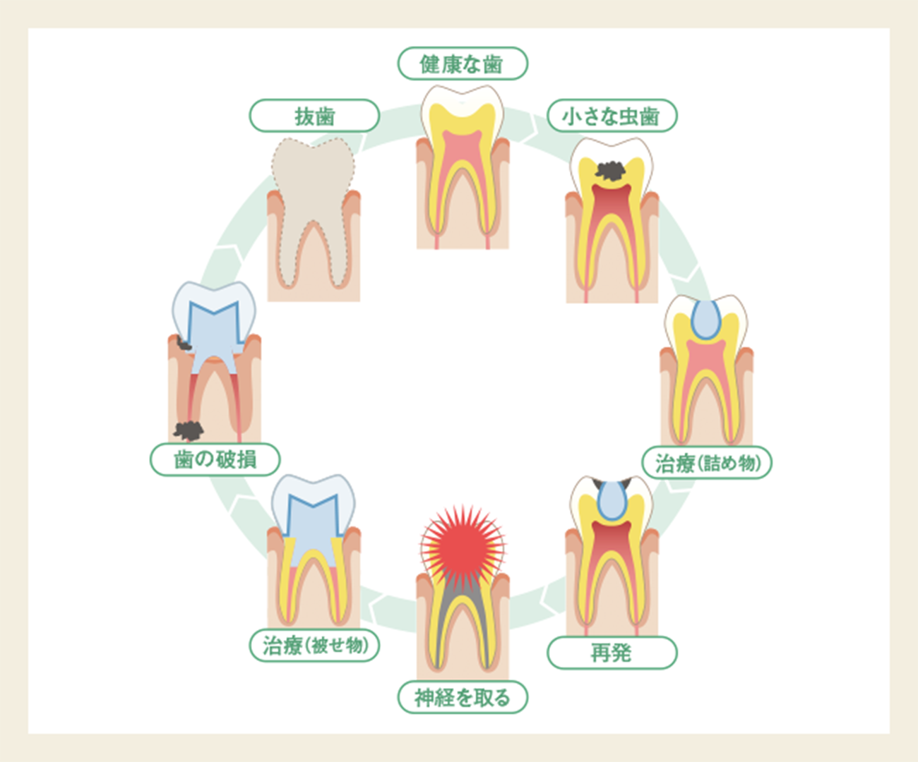 再発リスクに備える