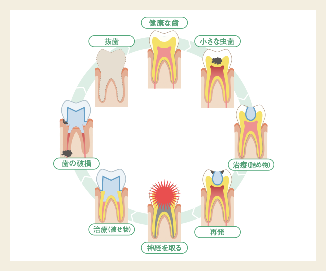 再発リスクに備える