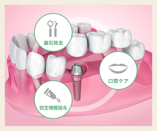 再発リスクに備える